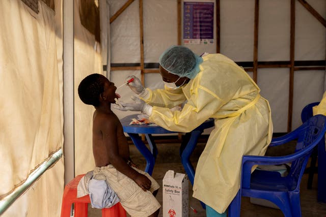 <p>Christian Musema, a laboratory nurse, takes a sample from a child declared a suspected case Mpox - an infectious disease caused by the monkeypox virus that spark-off a painful rash, enlarged lymph nodes and fever; at the the treatment centre in Munigi, following Mpox cases in Nyiragongo territory near Goma, North Kivu province, Democratic Republic of the Congo </p>