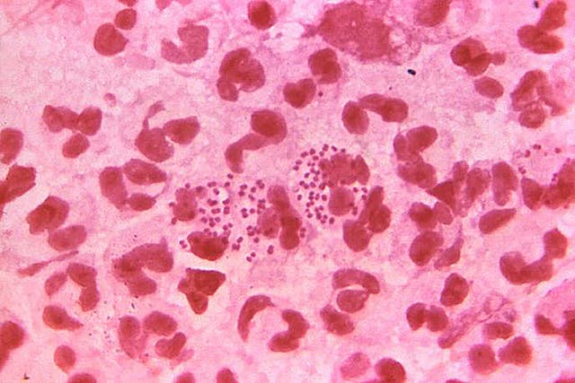 <p>Undated handout file photo issued by the Center for Disease Control and Prevention (CDC) of gonorrhoea bacteria (PA/CDC).</p>