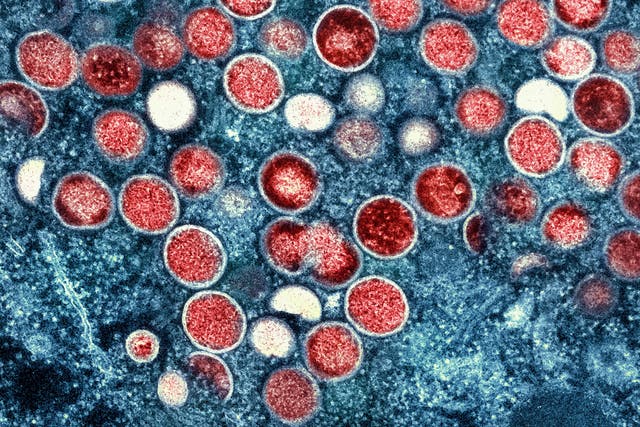 <p>Micrograph of mpox cells </p>