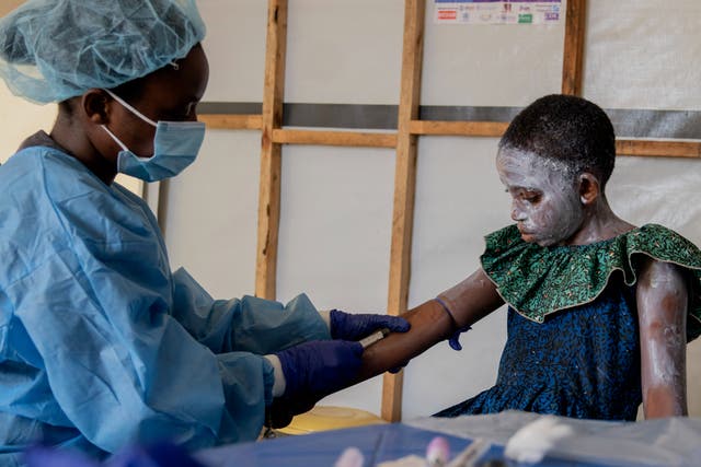 <p>A health worker attends to Lucie Habimana, 13, an mpox patient, at a treatment centre in Munigi, eastern Congo</p>