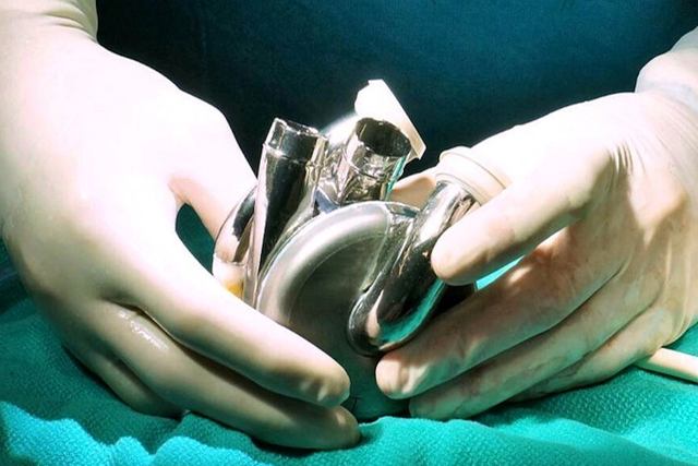 <p>Surgeon holding BiVACOR’s Total Artificial Heart (TAH)</p>